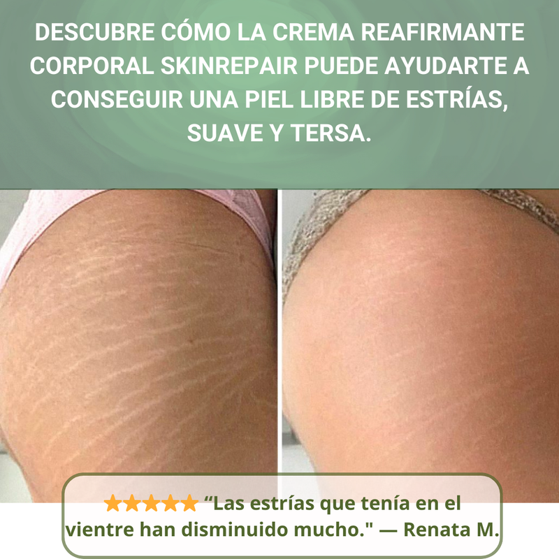 Crema Tratamiento Antiestrias Skinrepair