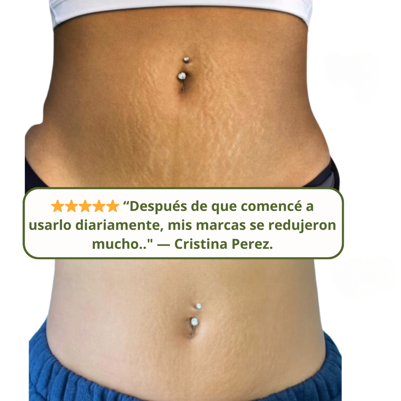 Crema Tratamiento Antiestrias Skinrepair