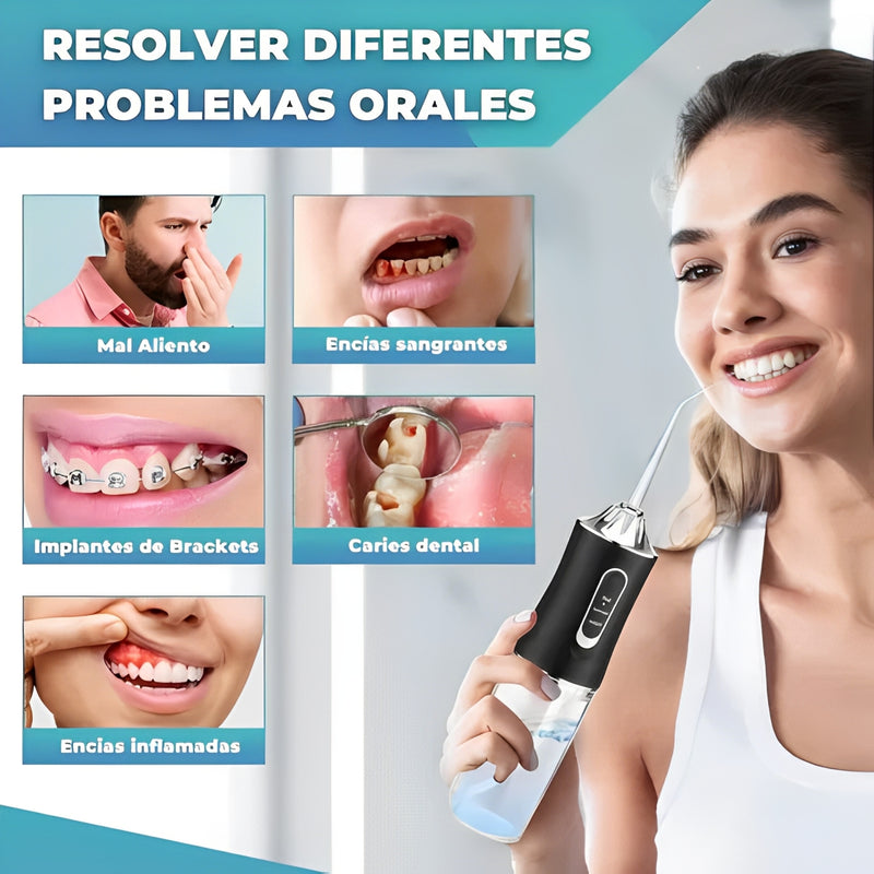 🌊 Irrigador Oral Recargable con 4 Boquillas 🔥 915 Vendidos - ¡Sólo 8 Unidades Disponibles!🔥